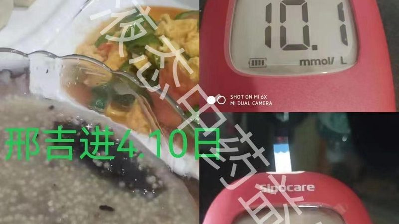 胶原蛋白对皮肤真的有用吗？揭秘其作用与科学依据